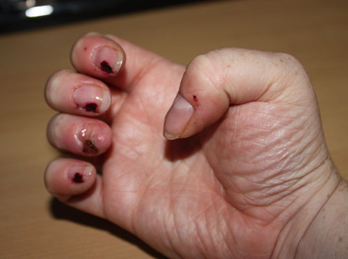 Curled fingers