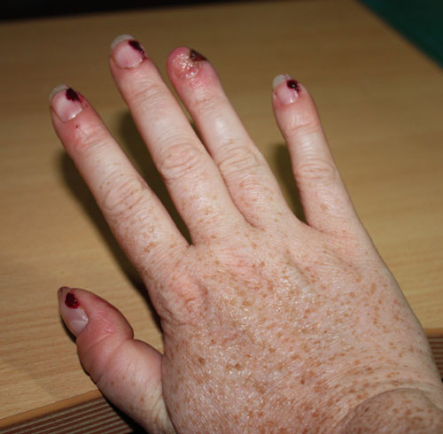 Straight fingers